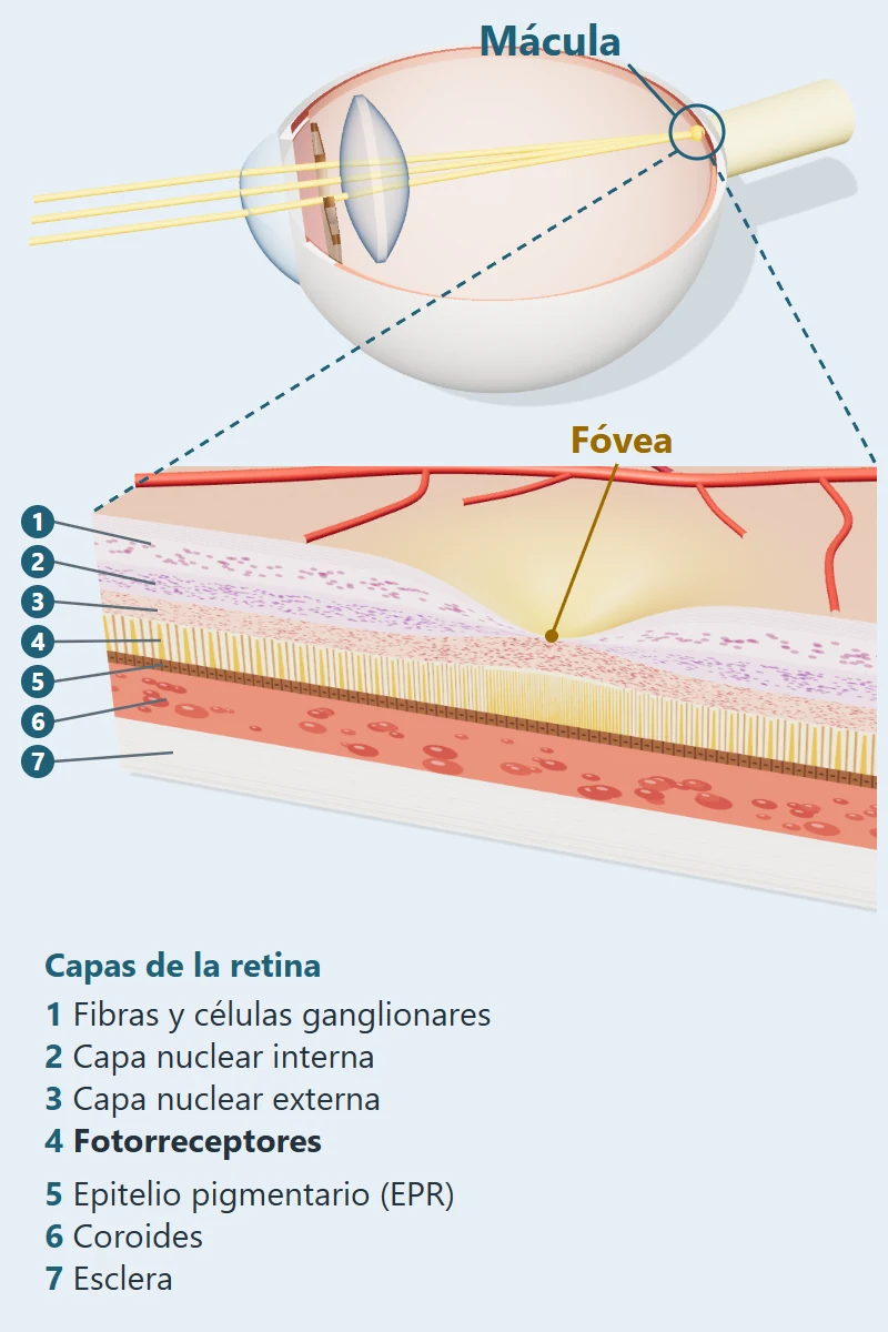 Ojo en corte con la mácula señalada y ampliación de la mácula con sus capas: retina, epitelio pigmentario, coroides y esclera
