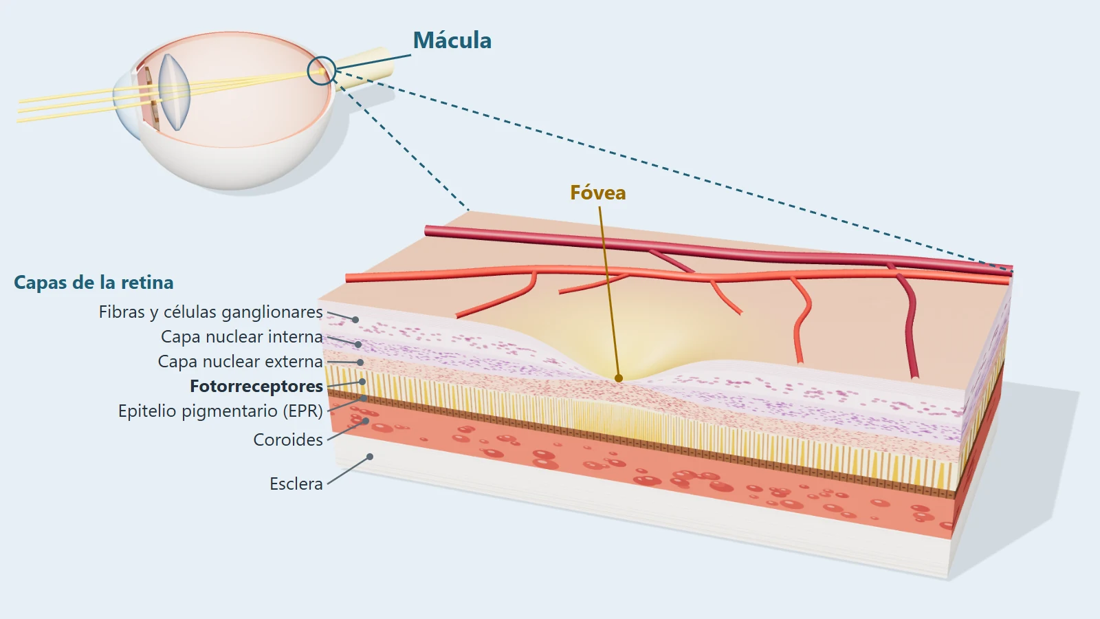 Ojo en corte con la mácula señalada y ampliación de la mácula con sus capas: retina, epitelio pigmentario, coroides y esclera